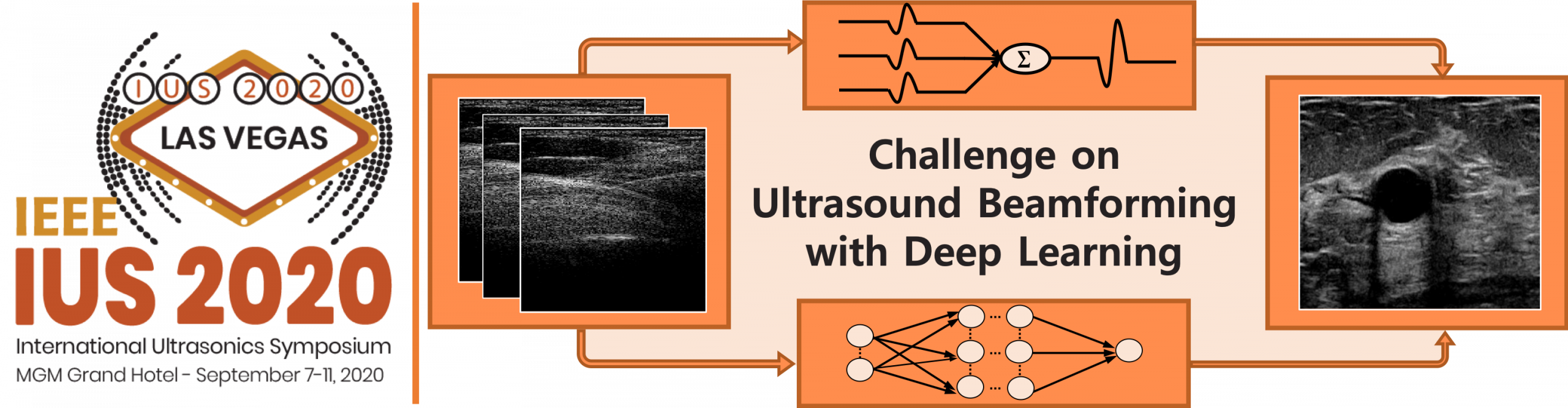 Challenge on Ultrasound Beamforming with Deep Learning